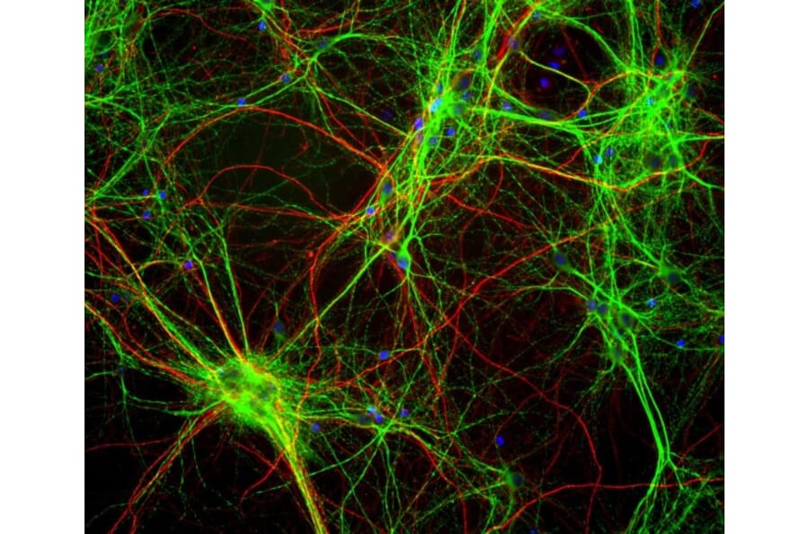 Immunofluorescence - Anti-MAP2 Antibody [5H11] (A85296) - Antibodies.com