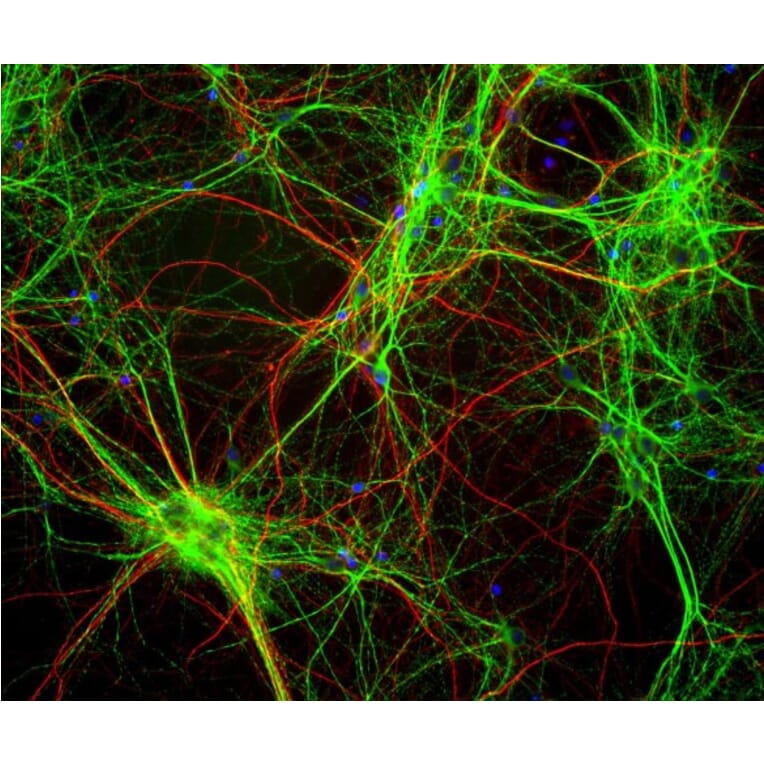 Immunofluorescence - Anti-MAP2 Antibody [5H11] (A85296) - Antibodies.com