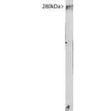 Western Blot - Anti-MAP2 Antibody [5H11] (A85296) - Antibodies.com