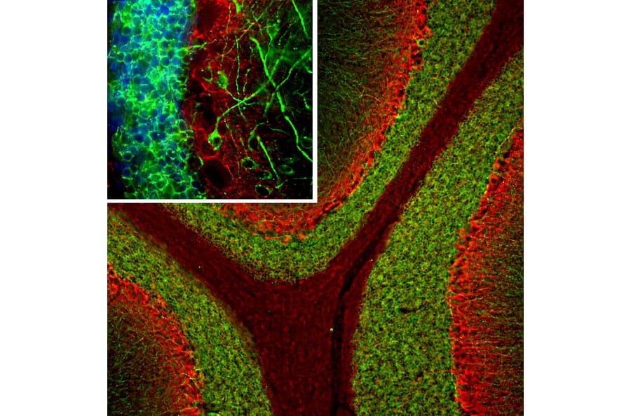 Immunofluorescence - Anti-MAP2 Antibody [5H11] (A85296) - Antibodies.com