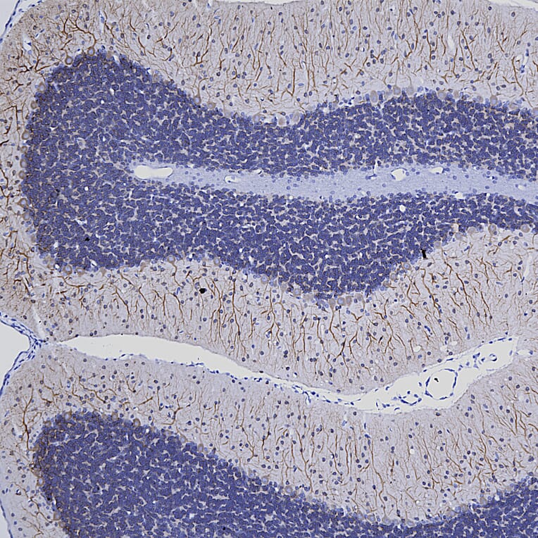 Immunohistochemistry - Anti-MAP2 Antibody [5H11] (A85296) - Antibodies.com