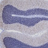Immunohistochemistry - Anti-MAP2 Antibody [5H11] (A85296) - Antibodies.com