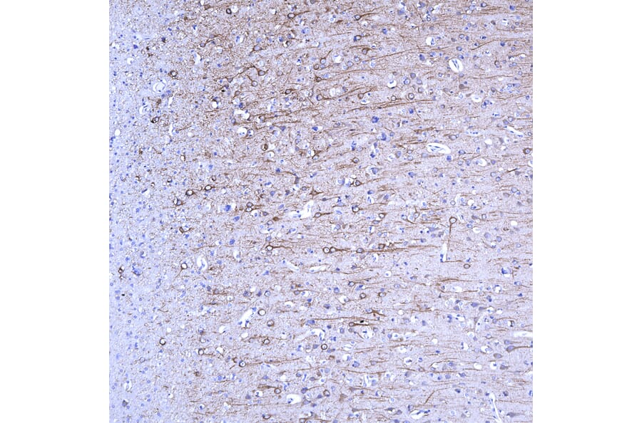 Immunohistochemistry - Anti-MAP2 Antibody [5H11] (A85296) - Antibodies.com