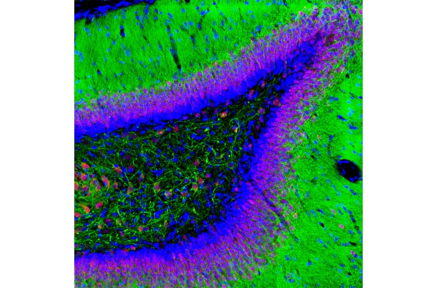 Immunofluorescence - Anti-MAP2 Antibody [4H5] (A85297) - Antibodies.com