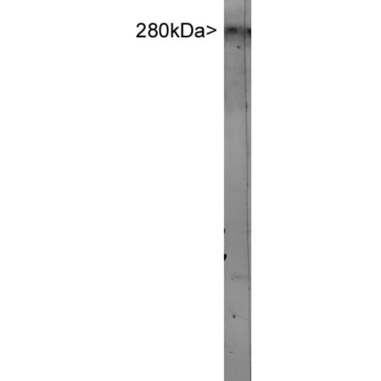 Western Blot - Anti-MAP2 Antibody (A85297) - Antibodies.com