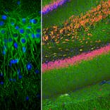 Immunofluorescence - Anti-MAP2 Antibody [4H5] (A85297) - Antibodies.com