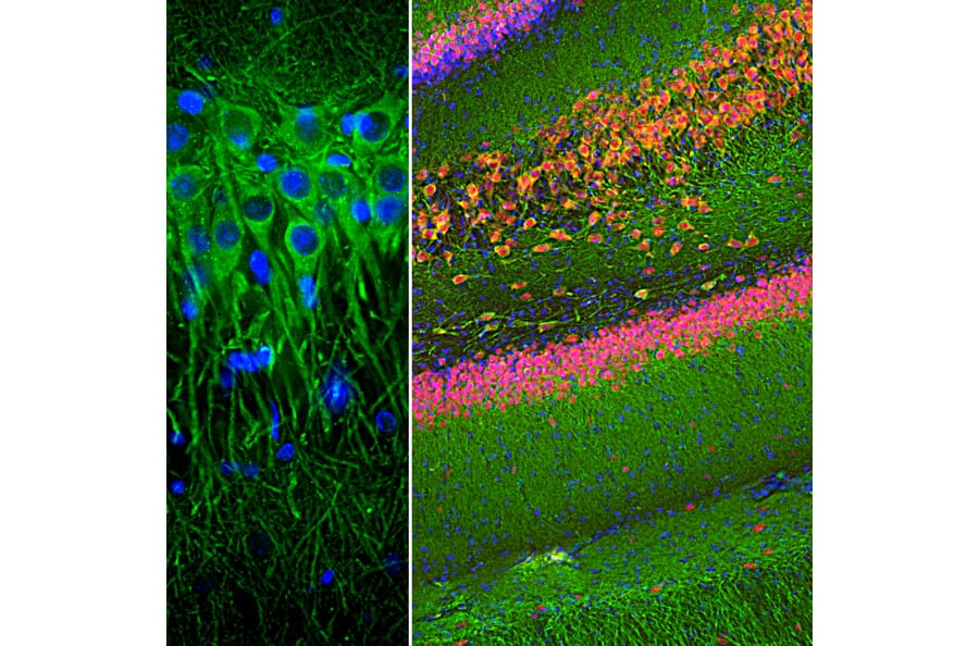 Immunofluorescence - Anti-MAP2 Antibody [4H5] (A85297) - Antibodies.com