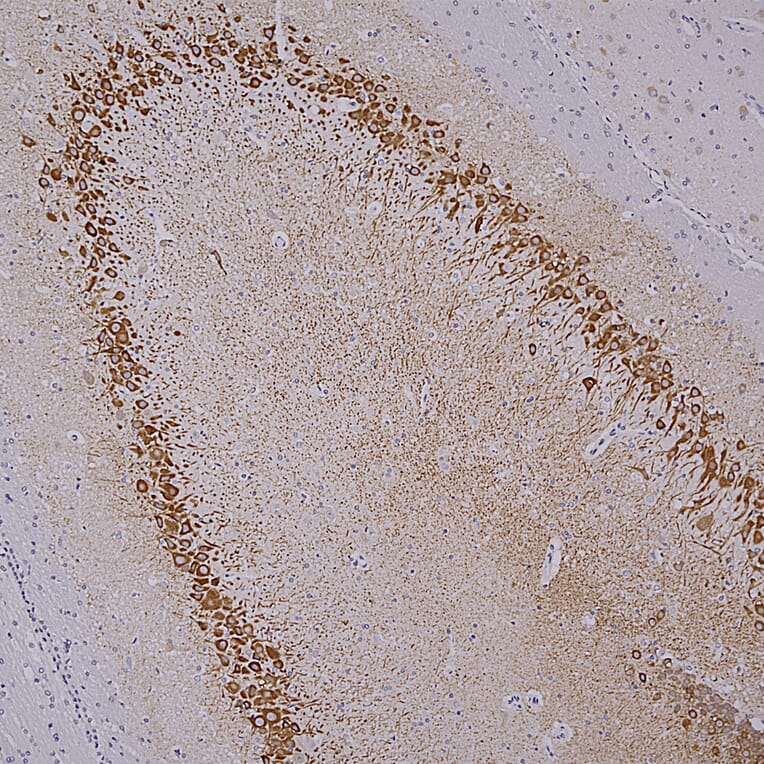 Immunohistochemistry - Anti-MAP2 Antibody [4H5] (A85297) - Antibodies.com
