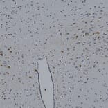 Immunohistochemistry - Anti-mCherry Antibody (A85304) - Antibodies.com