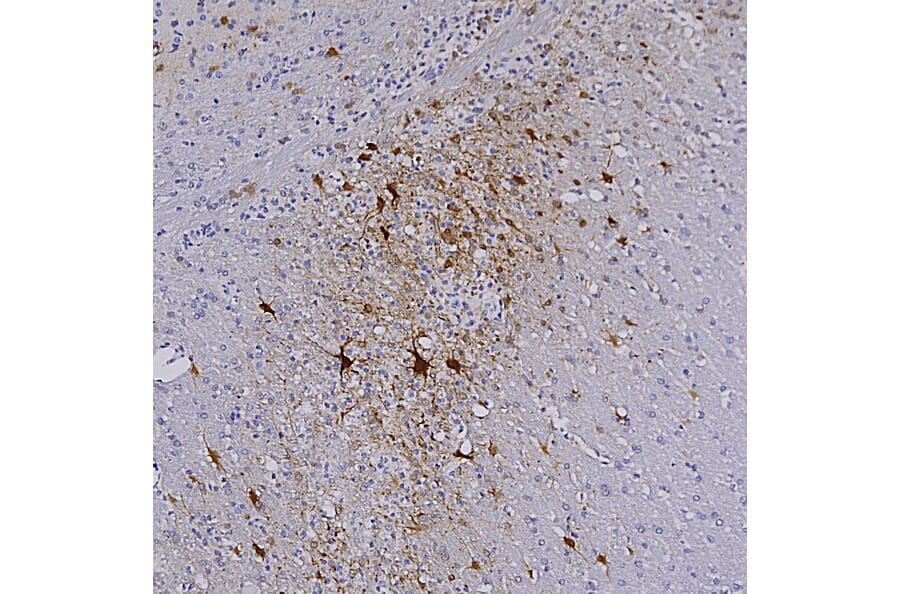 Immunohistochemistry - Anti-mCherry Antibody [1C51] (A85305) - Antibodies.com