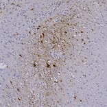 Immunohistochemistry - Anti-mCherry Antibody [1C51] (A85305) - Antibodies.com