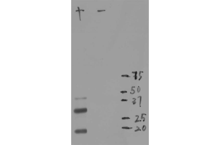 Western Blot - Anti-mCherry Antibody [1C51] (A85305) - Antibodies.com