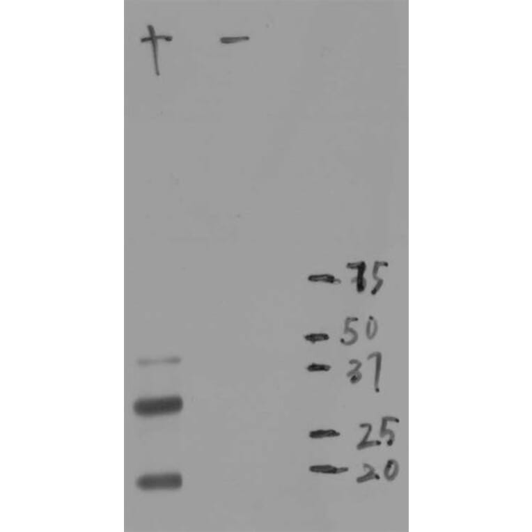 Western Blot - Anti-mCherry Antibody [1C51] (A85305) - Antibodies.com