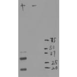 Western Blot - Anti-mCherry Antibody [1C51] (A85305) - Antibodies.com