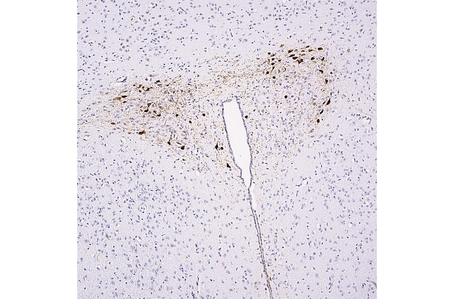 Immunohistochemistry - Anti-mCherry Antibody (A85306) - Antibodies.com