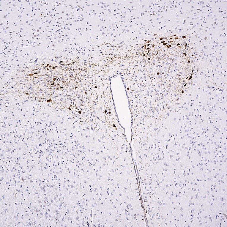 Immunohistochemistry - Anti-mCherry Antibody (A85306) - Antibodies.com