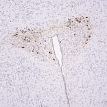 Immunohistochemistry - Anti-mCherry Antibody (A85306) - Antibodies.com