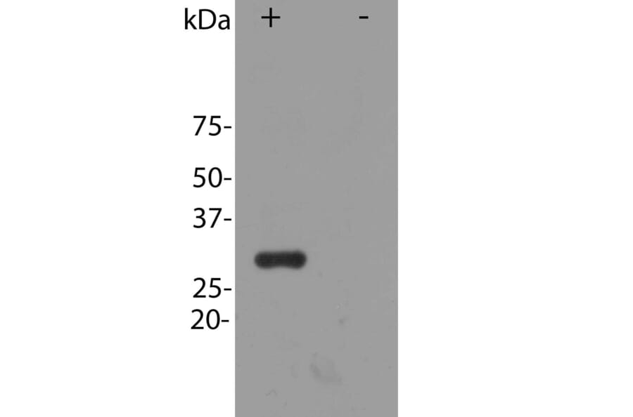 Western Blot - Anti-mCherry Antibody (A85306) - Antibodies.com