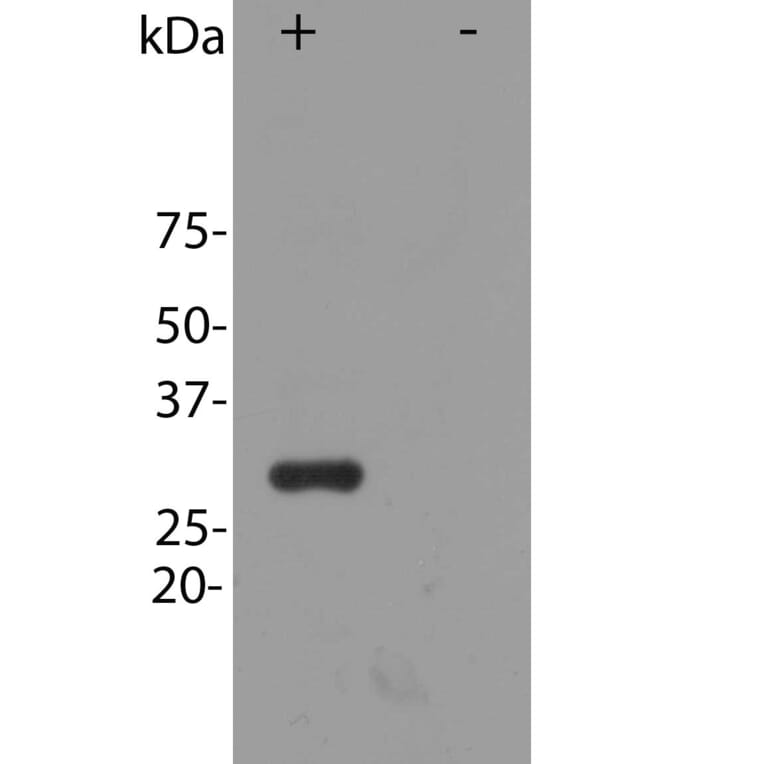 Western Blot - Anti-mCherry Antibody (A85306) - Antibodies.com