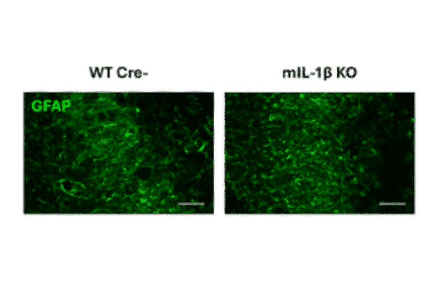 Immunofluorescence - Anti-GFAP Antibody (A85307) - Antibodies.com Citation