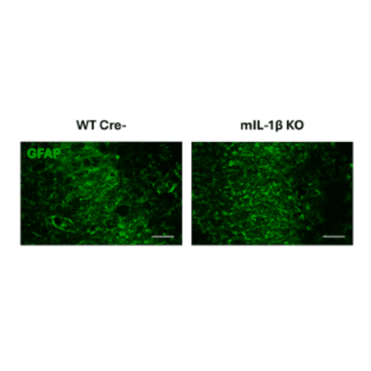 Immunofluorescence - Anti-GFAP Antibody (A85307) - Antibodies.com Citation