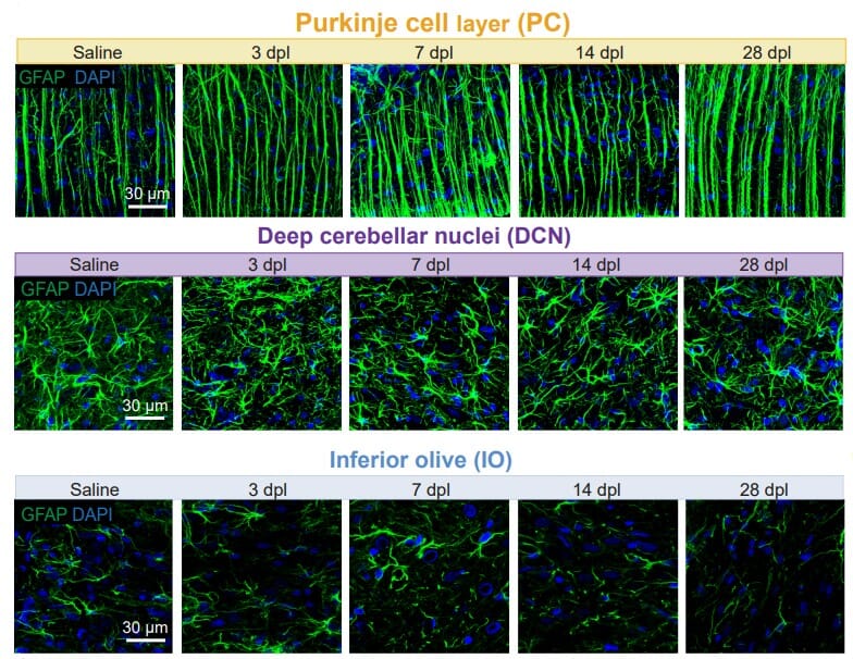 aka様 Anti-GFAP Antibody (A85307) | Antibodies.com