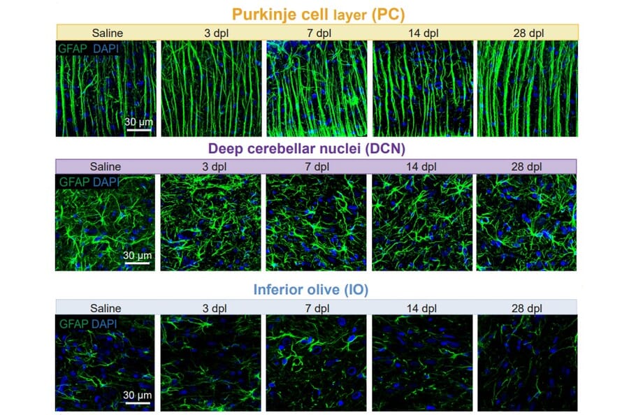 Immunofluorescnece - Anti-GFAP Antibody (A85307) - Antibodies.com
