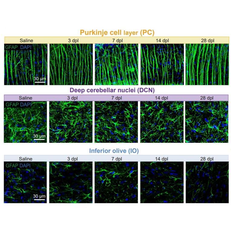 Immunofluorescnece - Anti-GFAP Antibody (A85307) - Antibodies.com