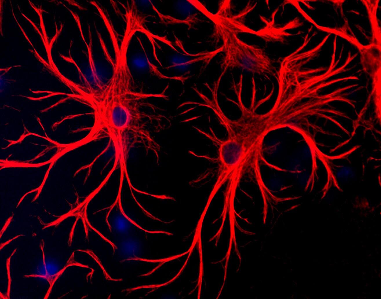 1384 hdppy様 Anti-GFAP Antibody (A85307) | Antibodies.com