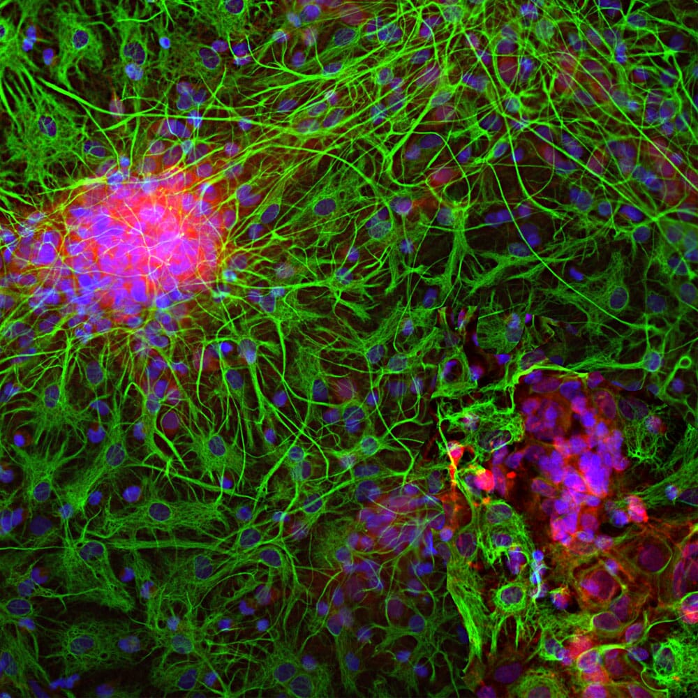Anti-GFAP Antibody (A85307) | Antibodies.com