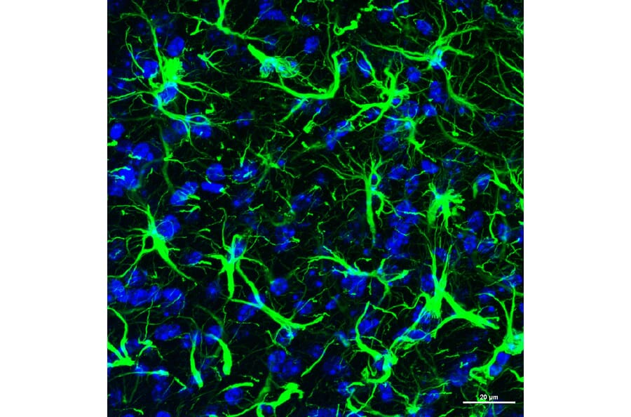 Immunofluorescence - Anti-GFAP Antibody (A85307) - Antibodies.com