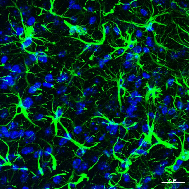 Immunofluorescence - Anti-GFAP Antibody (A85307) - Antibodies.com