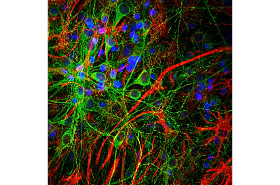Immunofluorescence - Anti-GFAP Antibody (A85307) - Antibodies.com