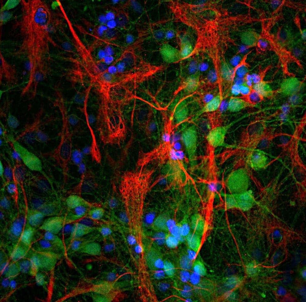 みやページ Anti-GFAP Antibody (A85307) | Antibodies.com