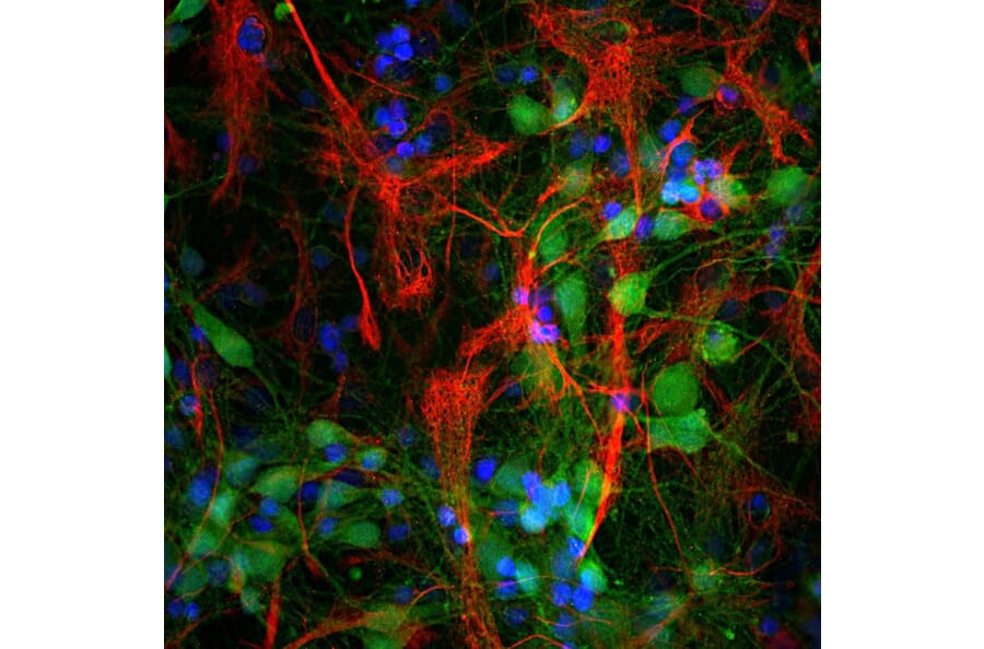 Immunofluorescence - Anti-GFAP Antibody (A85307) - Antibodies.com