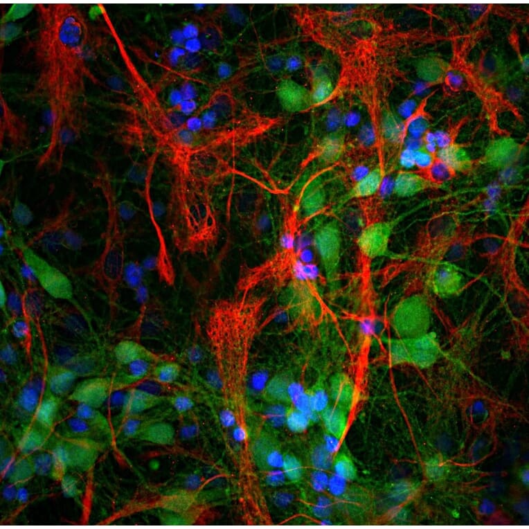 Immunofluorescence - Anti-GFAP Antibody (A85307) - Antibodies.com
