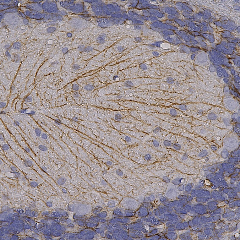 Immunohistochemistry - Anti-GFAP Antibody (A85307) - Antibodies.com