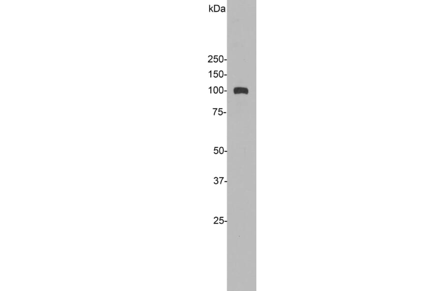 Western Blot - Anti-ALDH1L1 Antibody (A85310) - Antibodies.com