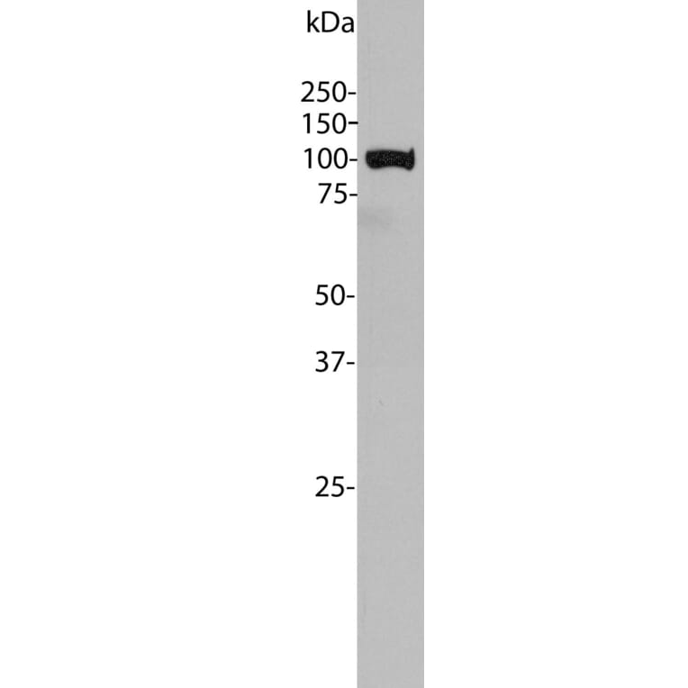 Western Blot - Anti-ALDH1L1 Antibody [4A12] (A85315) - Antibodies.com