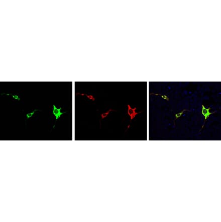 Immunofluorescence - Anti-Cas9 Antibody (A85318) - Antibodies.com