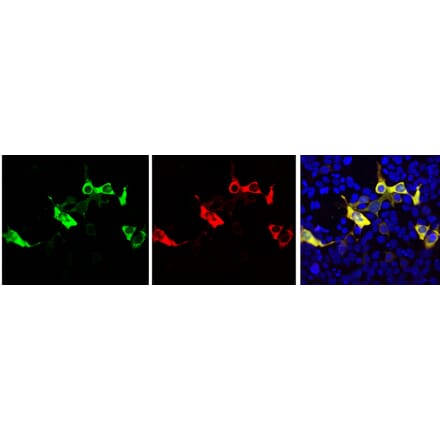 Immunofluorescence - Anti-Cas9 Antibody (A85320) - Antibodies.com