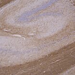 Immunohistochemistry - Anti-Myelin Basic Protein Antibody [7G7] (A85322) - Antibodies.com