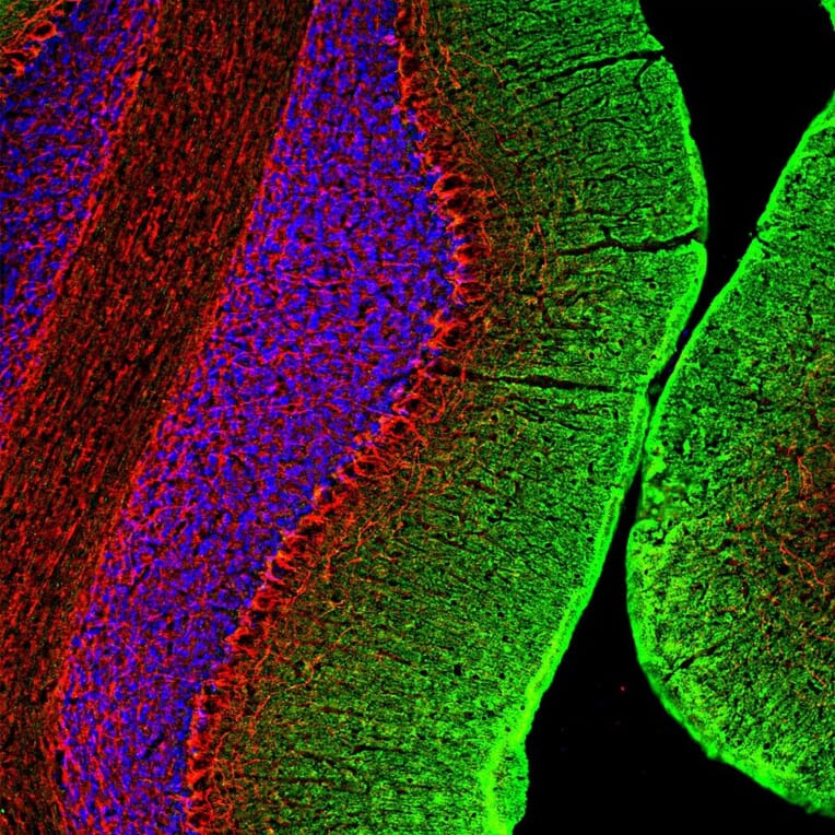 Immunofluorescence - Anti-NF-M Antibody (A85323) - Antibodies.com