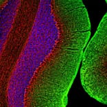 Immunofluorescence - Anti-NF-M Antibody (A85323) - Antibodies.com