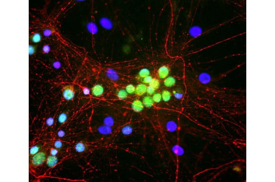 Immunofluorescence - Anti-NF-M Antibody (A85323) - Antibodies.com