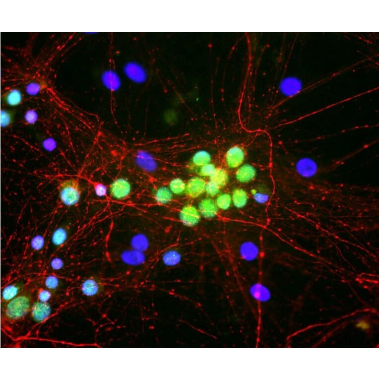 Immunofluorescence - Anti-NF-M Antibody (A85323) - Antibodies.com