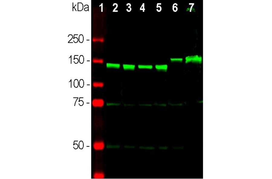 Western Blot - Anti-NF-M Antibody (A85323) - Antibodies.com