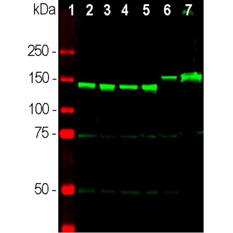 Western Blot - Anti-NF-M Antibody (A85323) - Antibodies.com