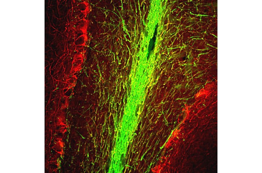 Immunofluorescence - Anti-NF-M Antibody (A85323) - Antibodies.com