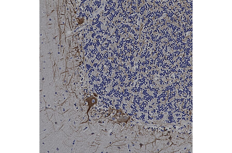 Immunohistochemistry - Anti-NF-M Antibody (A85323) - Antibodies.com
